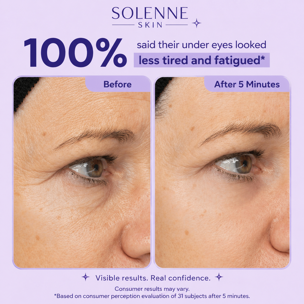 Solenne Skin Instant Lift Eye Gel