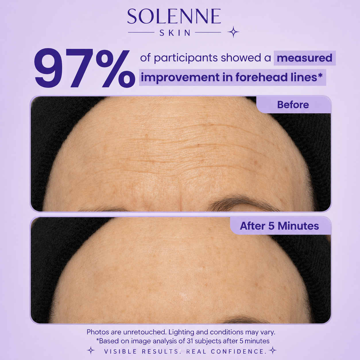 Solenne Skin Instant Lift Eye Gel